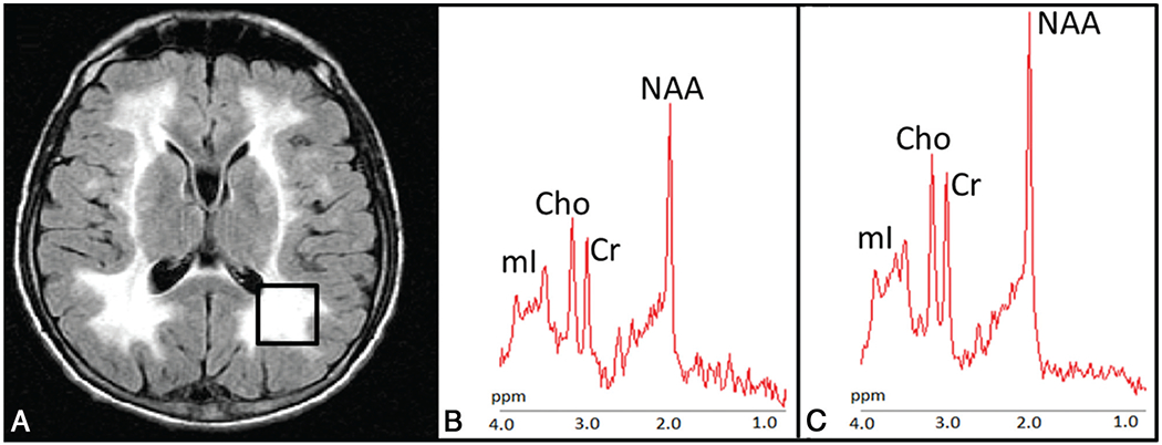 FIG 2.