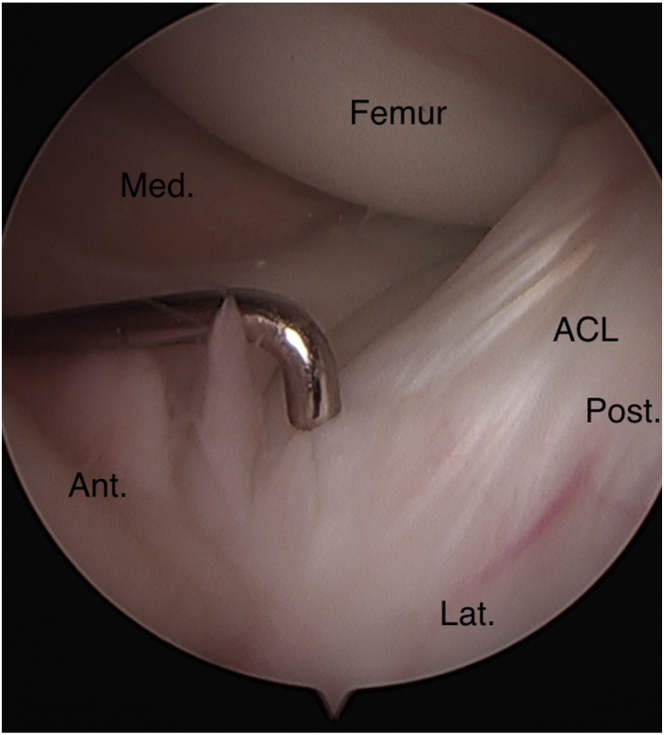 Fig 23