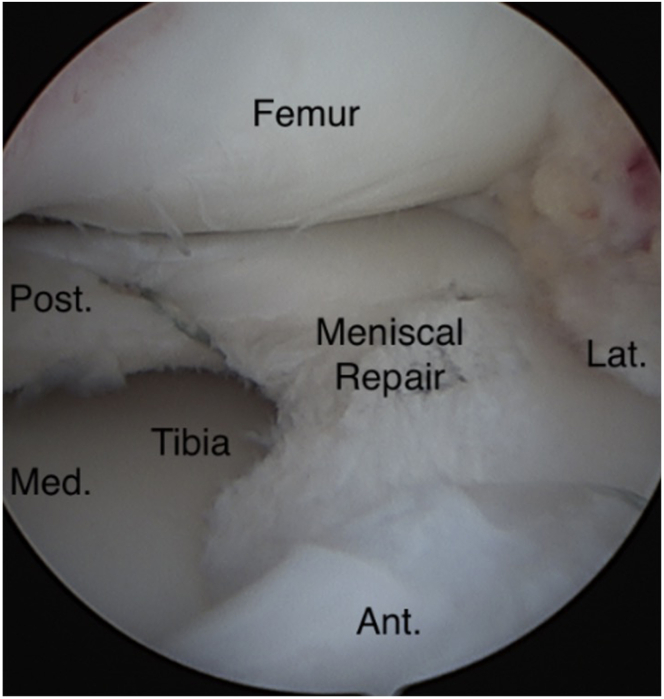 Fig 30