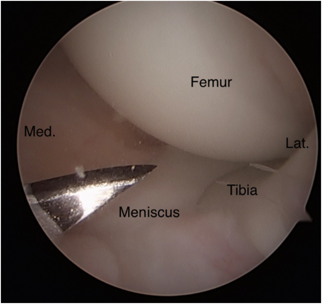 Fig 21