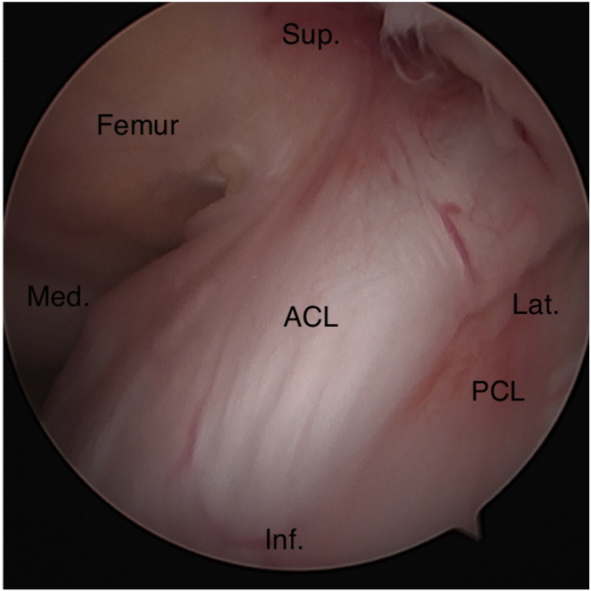 Fig 24