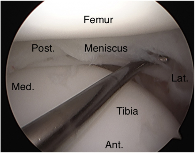 Fig 28