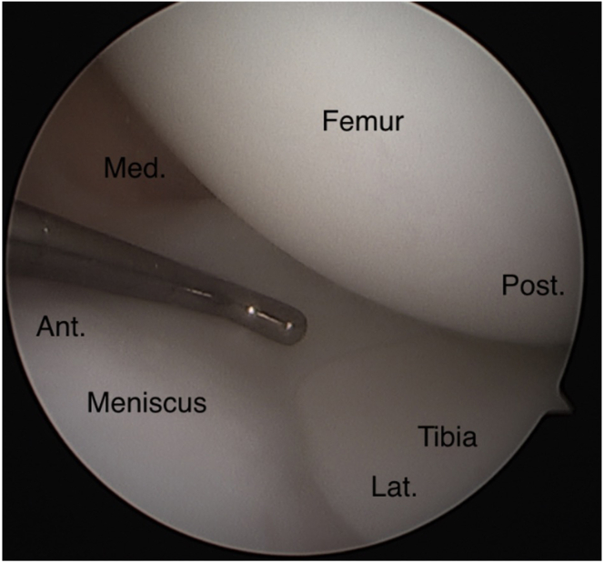 Fig 22