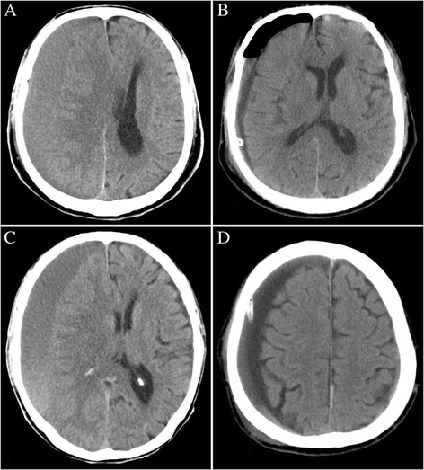 Fig. 1