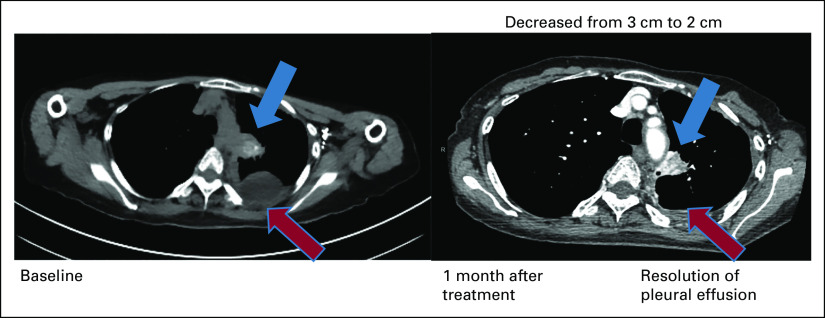 FIG 3.