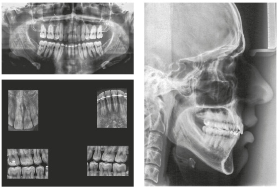 Figure 13