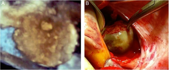 Figure 3