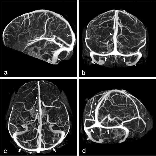 Fig 1.