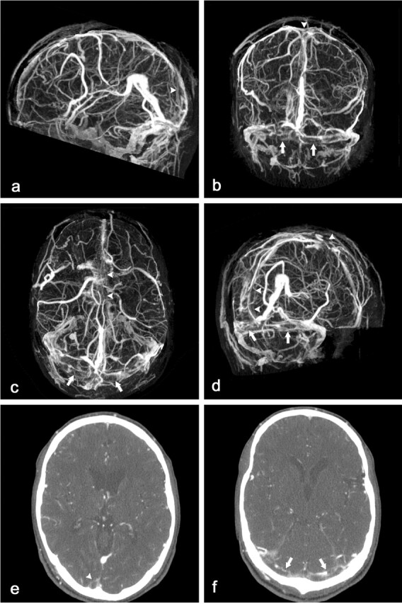 Fig 2.