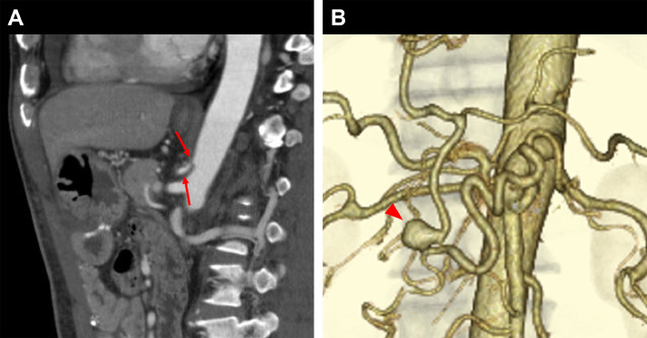 Fig 3