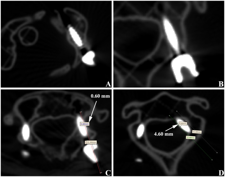 Fig 5