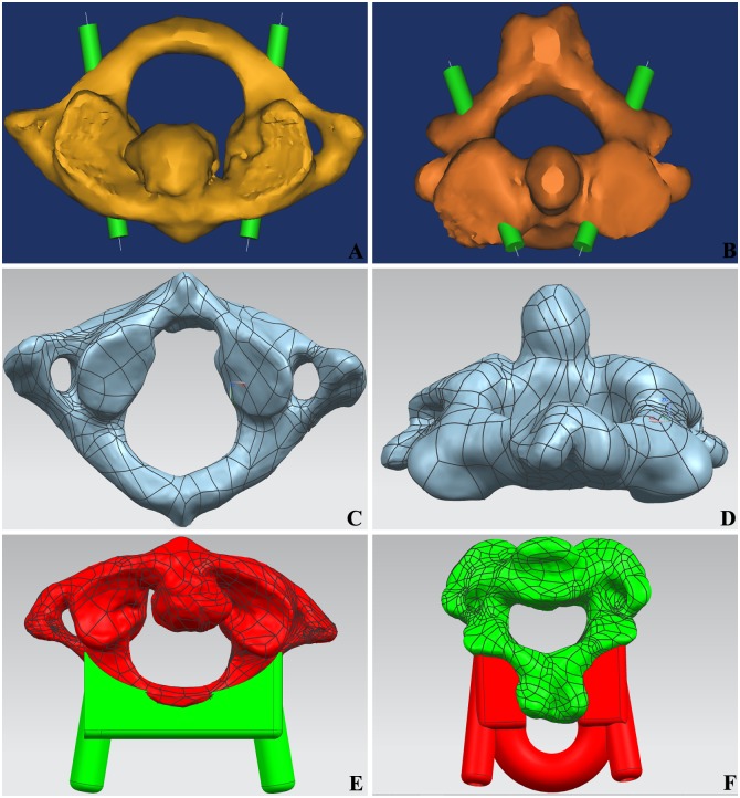 Fig 1