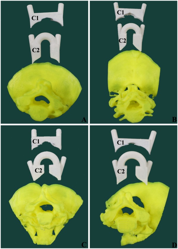 Fig 2