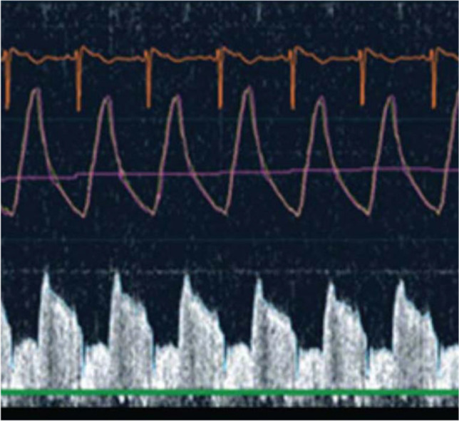 Fig. 3