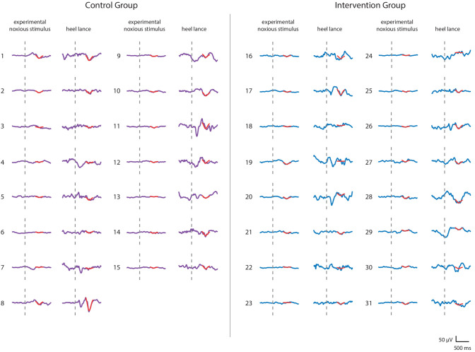 Figure 3—figure supplement 1.