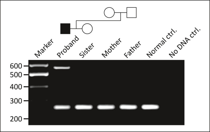 FIGURE 3