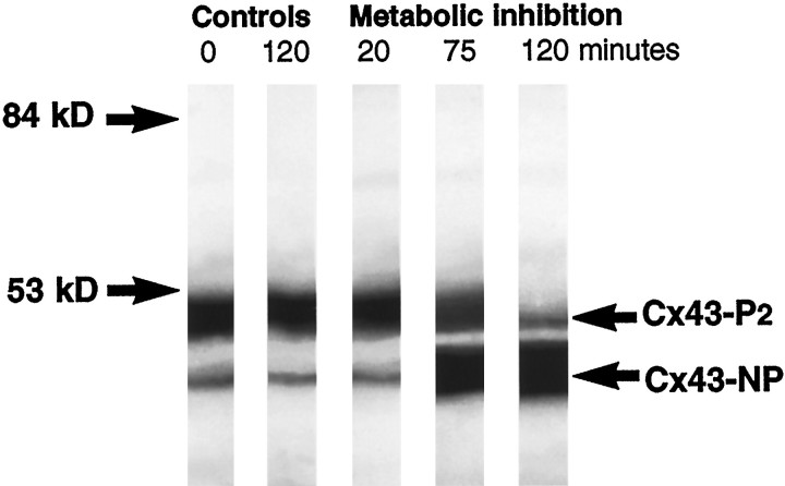 Fig. 14.