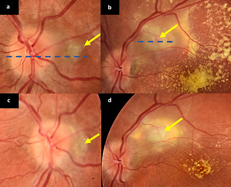 Fig. 1