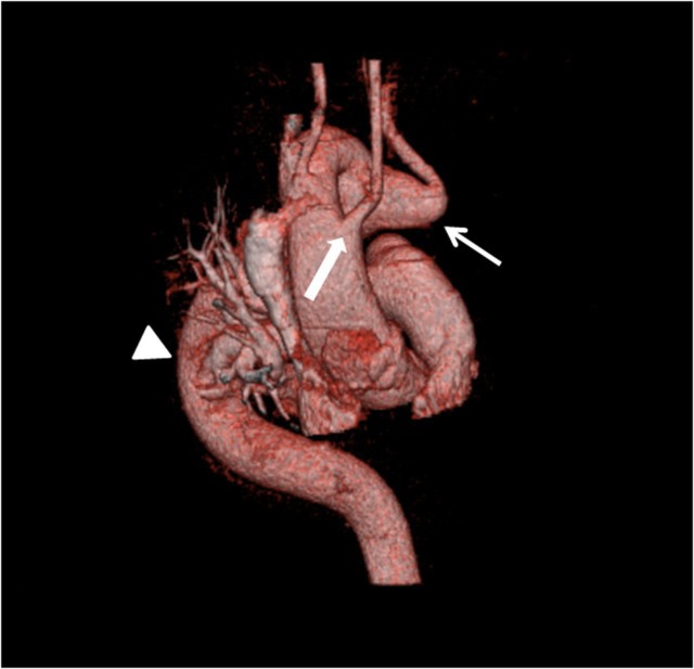 Fig. 3