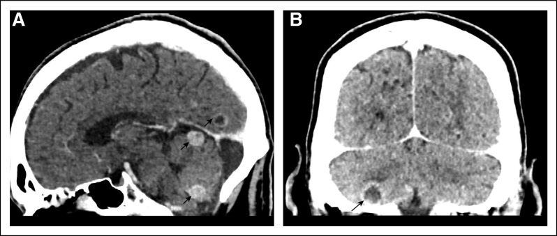 FIG 2