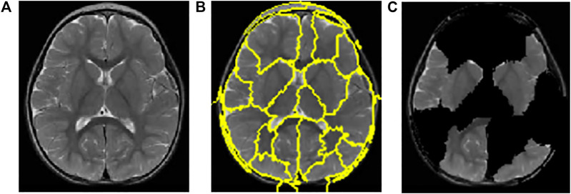 FIGURE 6