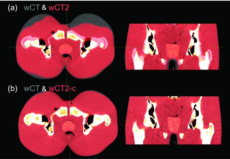 FIG. 6.