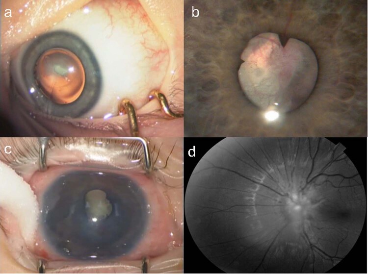 Fig. 3