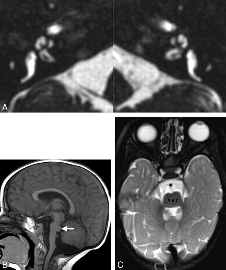 Fig 3.