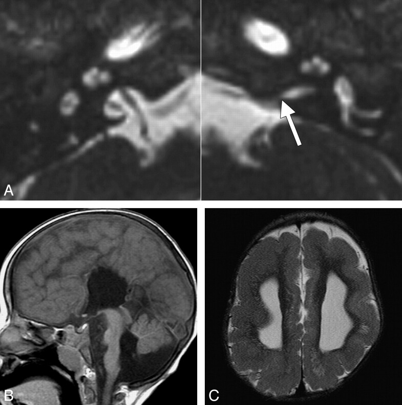 Fig 2.