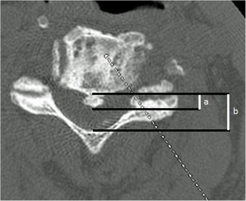 Fig. 3