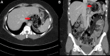Figure 1 (A)