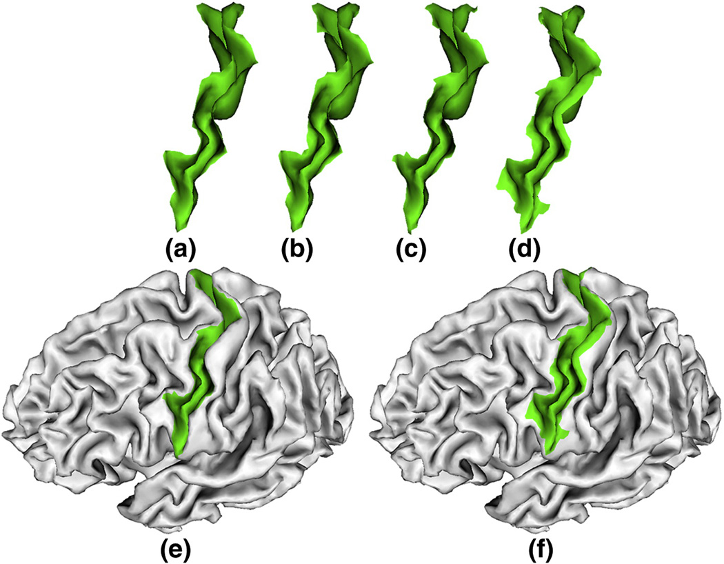 Figure 14