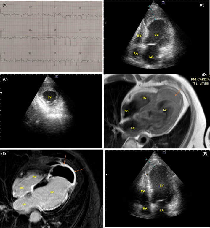 FIGURE 2