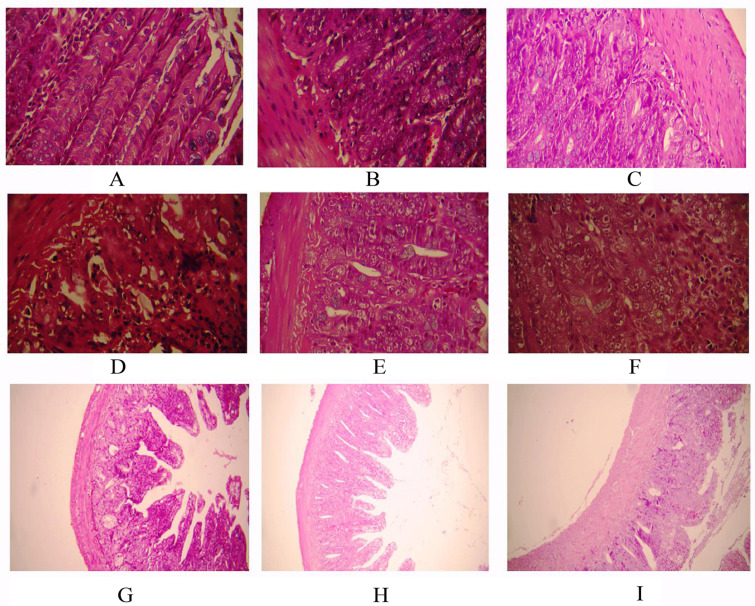 Fig. (1)