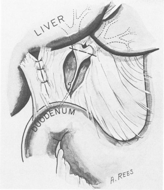 Fig. 1a.