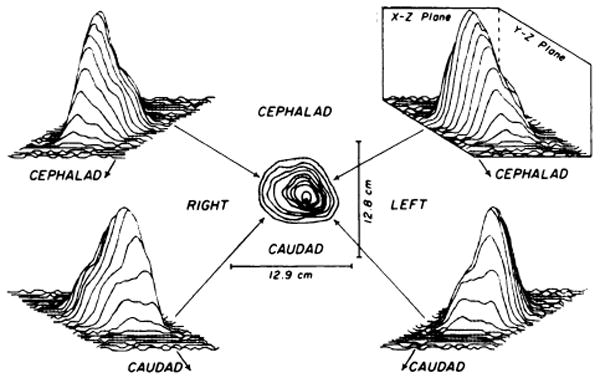 FIG. 3