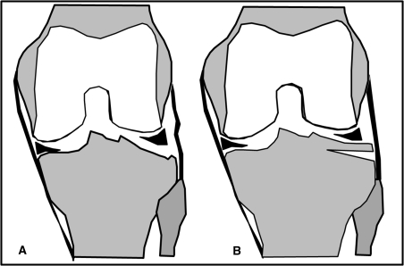 Fig. 3A–B