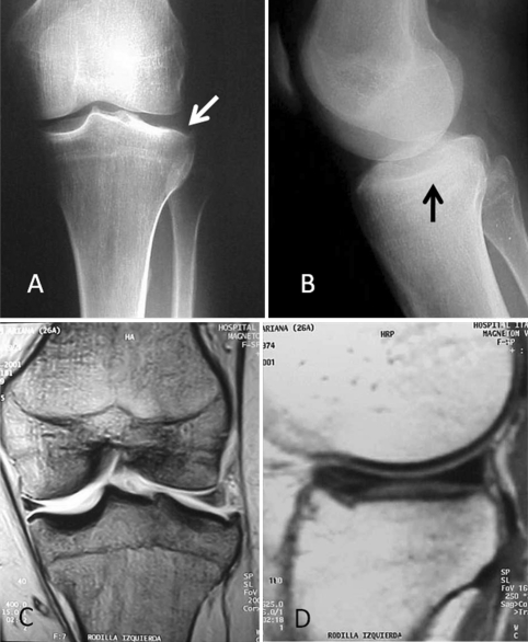 Fig. 1A–D