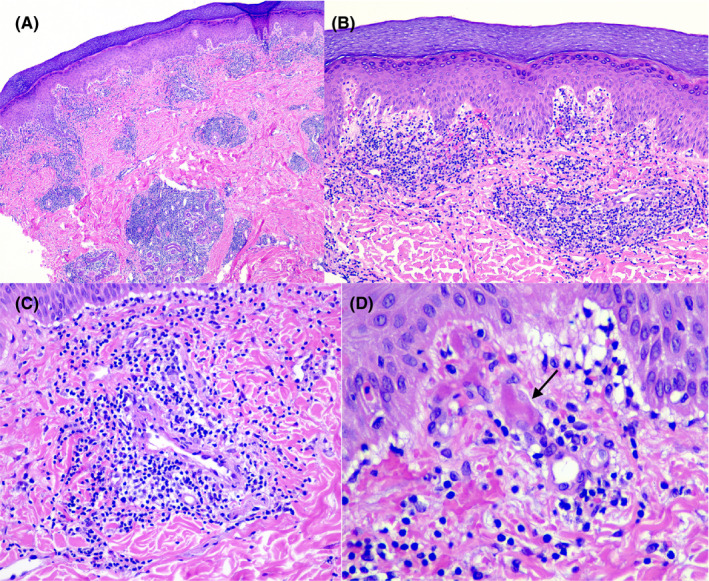 FIGURE 3