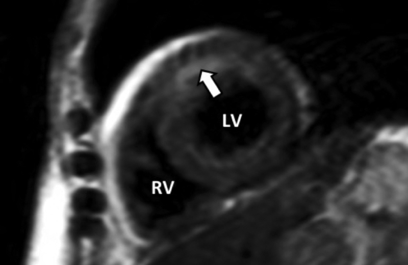 Figure 4: