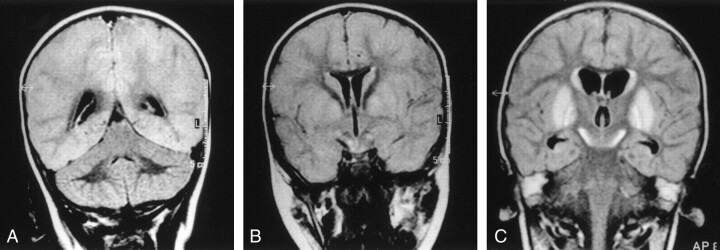 Fig 2.