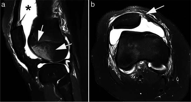 Fig. 4