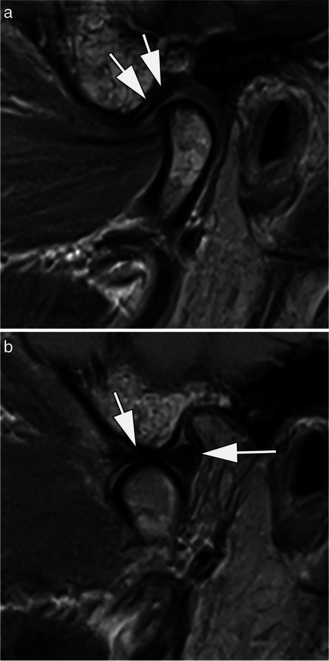 Fig. 7