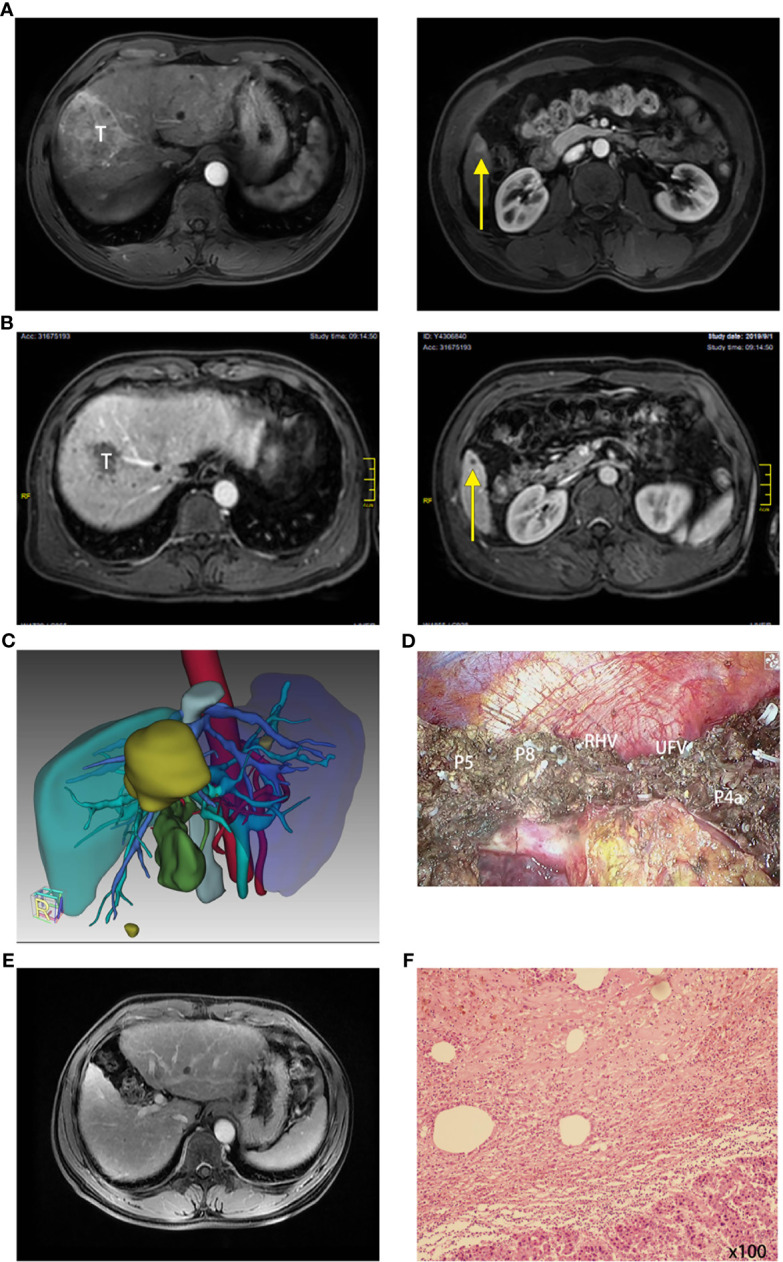 Figure 3