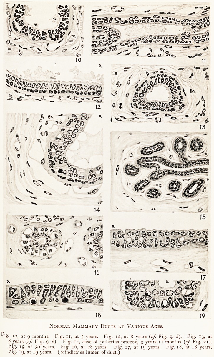 Fig. 10, Fig. 11, Fig. 12, Fig. 13, Fig. 14, Fig. 15, Fig. 16, Fig. 17, Fig. 18, Fig. 19,