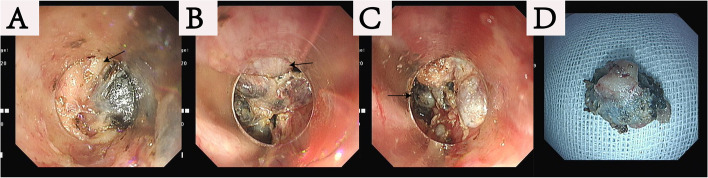 Fig. 4