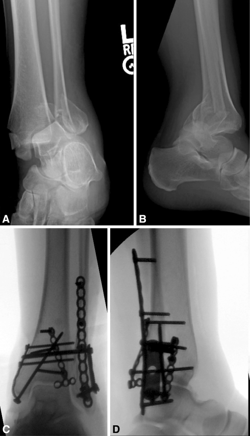 Fig. 3A–D 