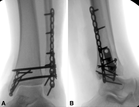 Fig. 2A–B