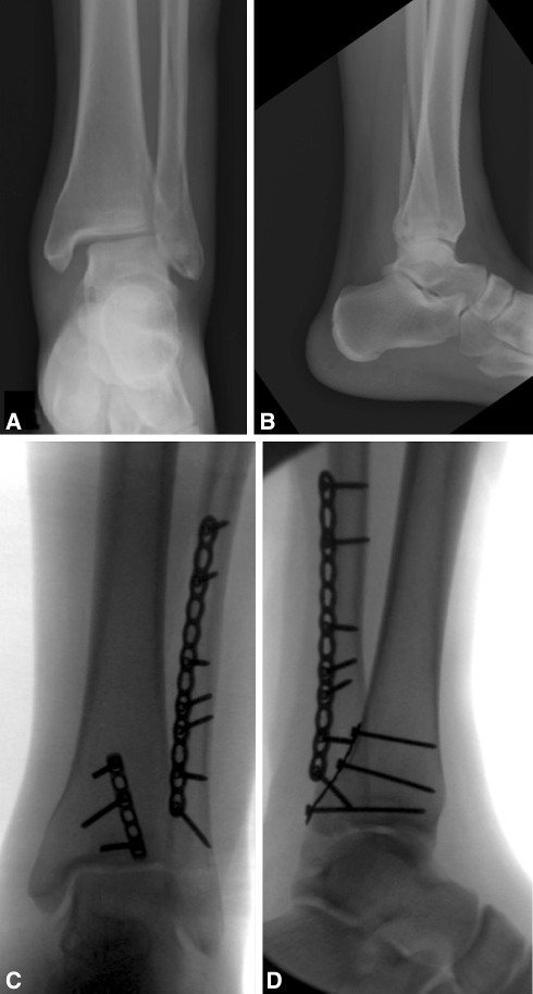 Fig. 1A–D