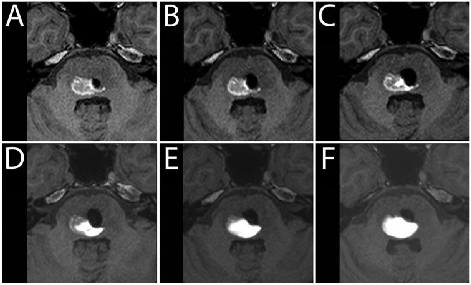 FIG. 5.